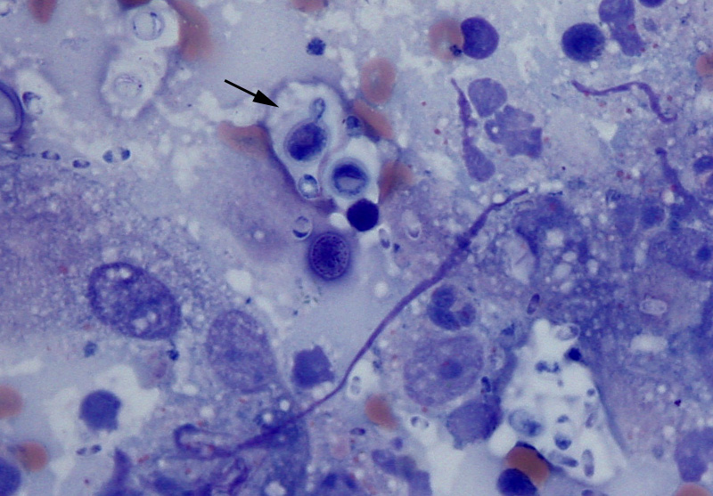 Infectious agents (cytology) eClinpath