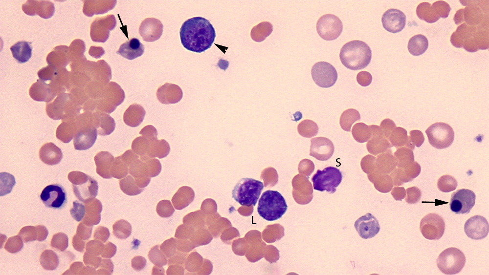 Blood From A Dog With Immune Mediated Hemolytic Anemia Nrbc Vs Lymph