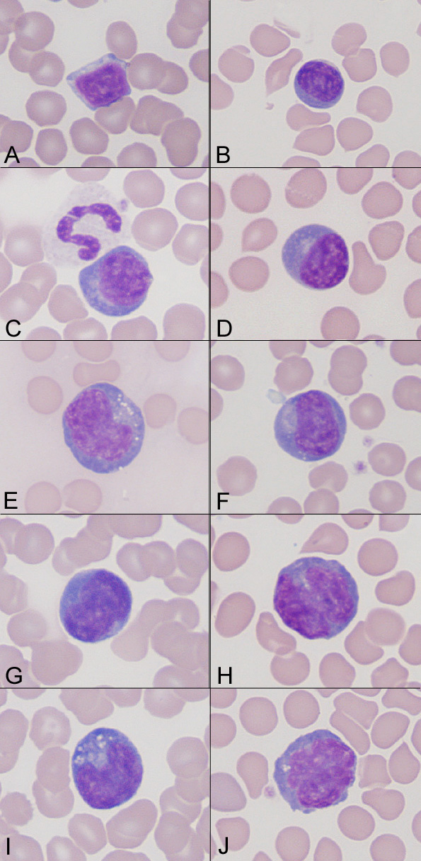 Reactive Lymphocytes In A Dog Eclinpath